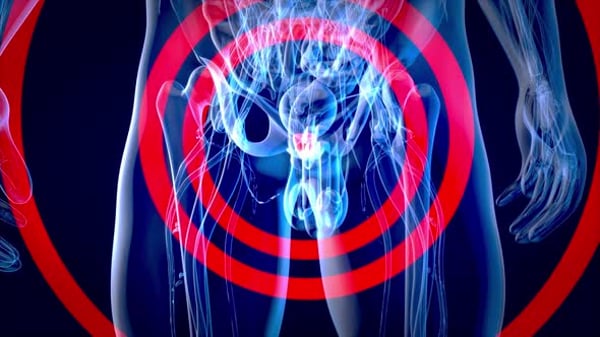 3D Animation of Male Pelvic Pain and Prostate Inflammation, Backgrounds ...