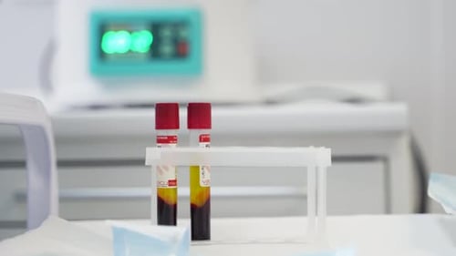 Doctor in Gloves Works with Blood Test Tubes for Analysis of Chinese Coronavirus Scientist