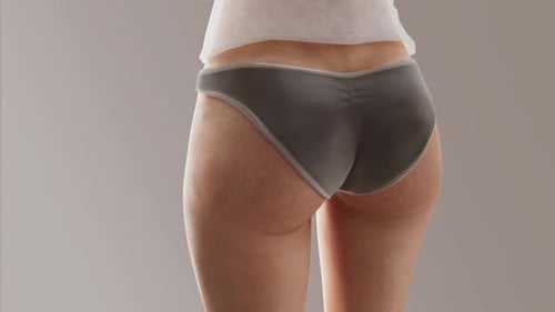 Animated Cellulite Removal Process on Female Thighs