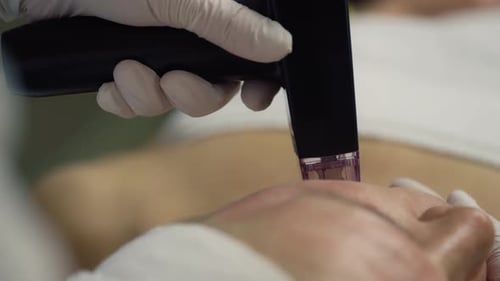 A Closeup of a Beautician Using a Device to Lift the Skin of a Woman's Face