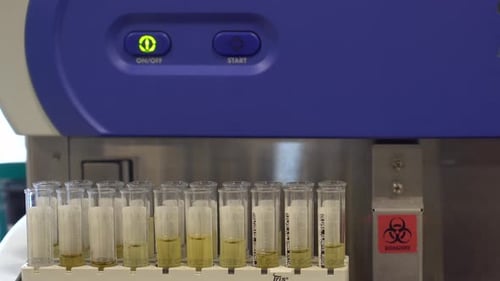 Urine Samples in Test Tubes Being Tested