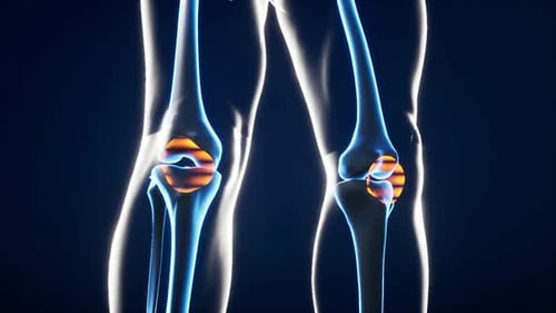Futuristic 3D Scan of Human Knee Joints and Bones