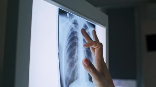 Physician Hand Touching Xray Scan of Human Lungs at Private Clinic Closeup