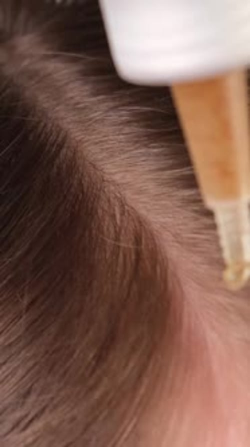 Close Up of Hair with Scalp Treatment