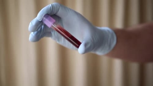 Gloved Hand Gently Shakes Blood Sample Tube
