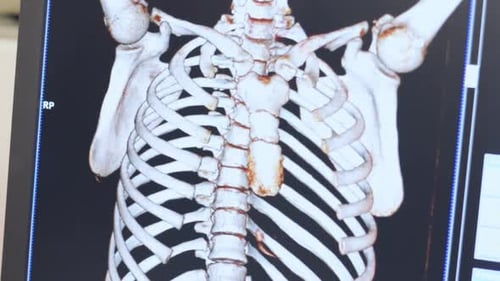 Magnetic Resonance Imaging Of Human Skeleton On Display. Professional Radiography Expertise And C...