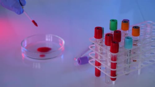 Pipette Drops Blood into Petri Dish in Lab