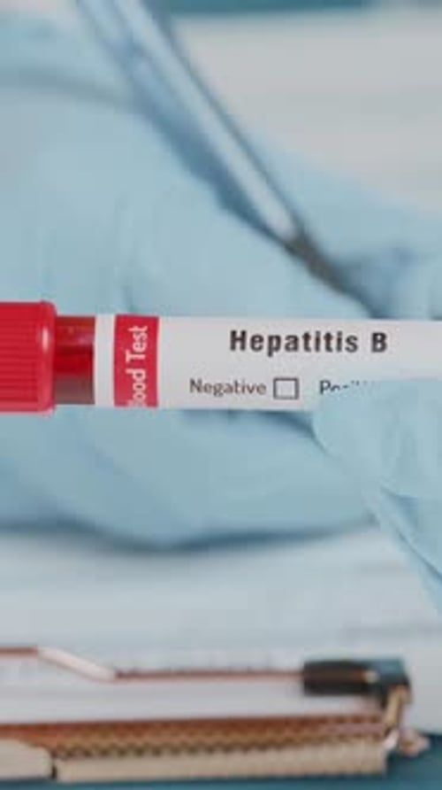 Blood Test for Hepatitis B in Laboratory Setting