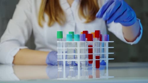 Scientist Analyzing Blood Samples in Test Tubes