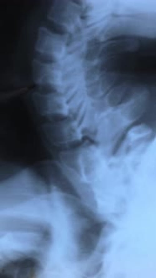 Cervical