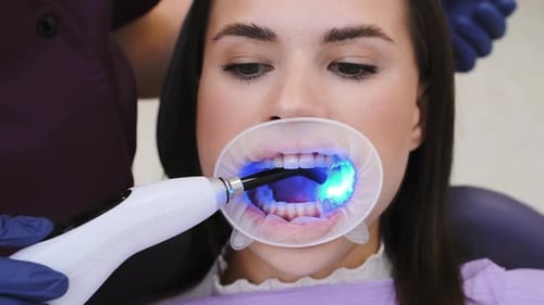 Un dentiste utilise une obturation dentaire durcissant aux rayons UV en clinique