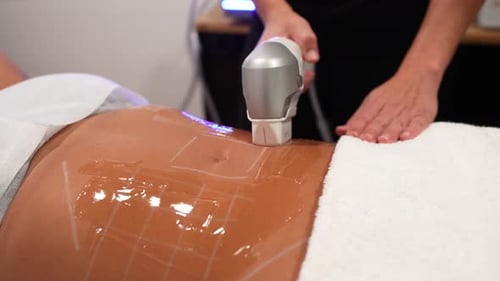 Woman Receiving Non-Invasive Cosmetic Procedure at Medical Spa