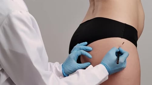 Doctor Marking Patient for Cosmetic Procedure