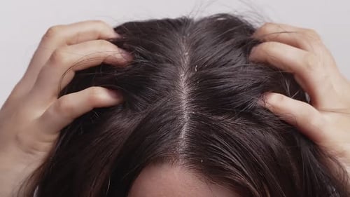Person Scratching Scalp Close Up
