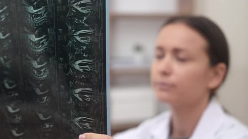 Close Up Orthopedic Doctor Evaluates Patient Xray Films and MRI Scans Looks Worried
