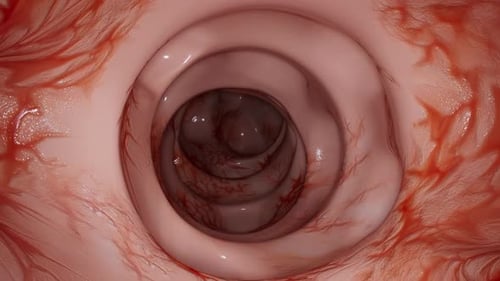 Human Colon Medical Flythrough Animation