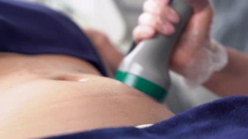 Procédure de traitement des graisses par cryolipolyse dans la clinique de cosmétologie moderne, liposuccion non chirurgicale pour