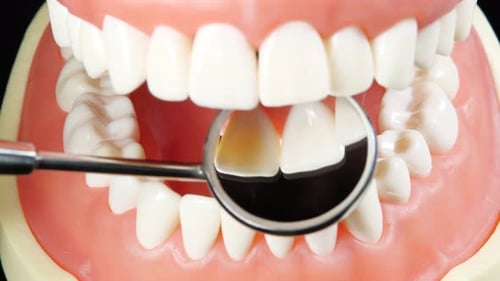 Patient at a Dentist Appointment in a Dental Clinic. View to Inside the Dental Jaw. Tooth Model