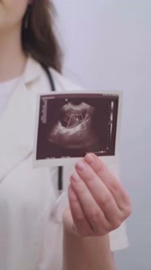 L'obstétricien-gynécologue examine attentivement l'image échographique pour créer un plan de traitement personnalisé