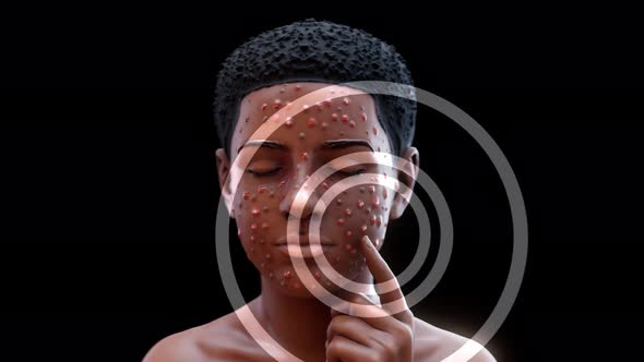 Conceptual 3D animation of a teenager with acne, Backgrounds Motion ...
