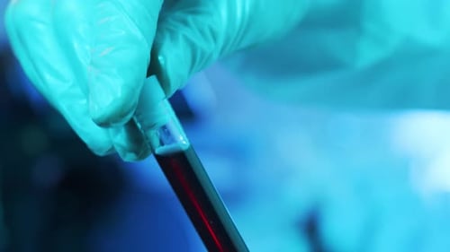 Laboratory Tubes with Blood and Virus Closeup of Scientific Lab in Hospital Epidemic Disease