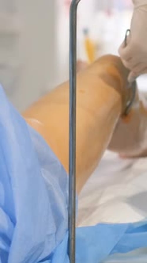 A Phlebologist at the Venous Vascular Surgery Clinic Performs Leg Operations Vertical Video
