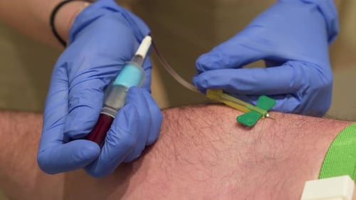 Doctor drawing blood to patient arm with butterfly needle and tubes. Close up.