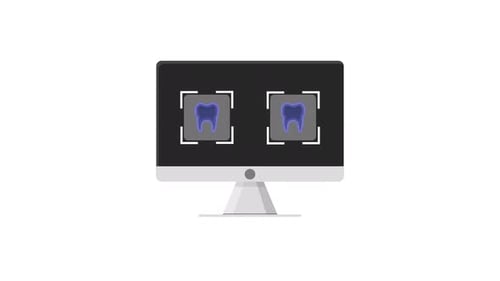Animated Dental X-Ray Scan on Computer Monitor