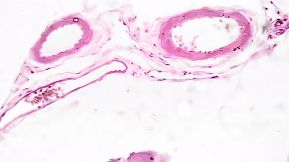 Macro Scientific Slide of Human Pancreas Tissue Magnified Under ...