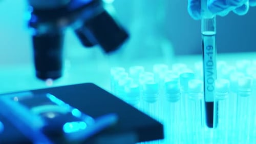 Microscope and a Tube with Virus Closeup of Scientific Laboratory in Hospital Epidemic Disease