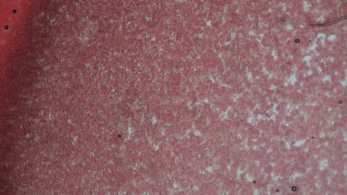 Fresh blood seen on a microscope view. Blood smear under microscope present plasma