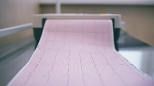 un cardiólogo hace un cardiograma de ECG para que un paciente imprima un análisis de la frecuencia del pulso del paciente