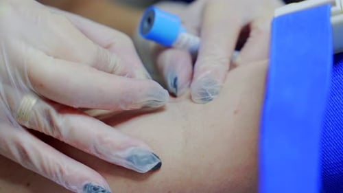 Medical Professional Draws Blood for Blood Test