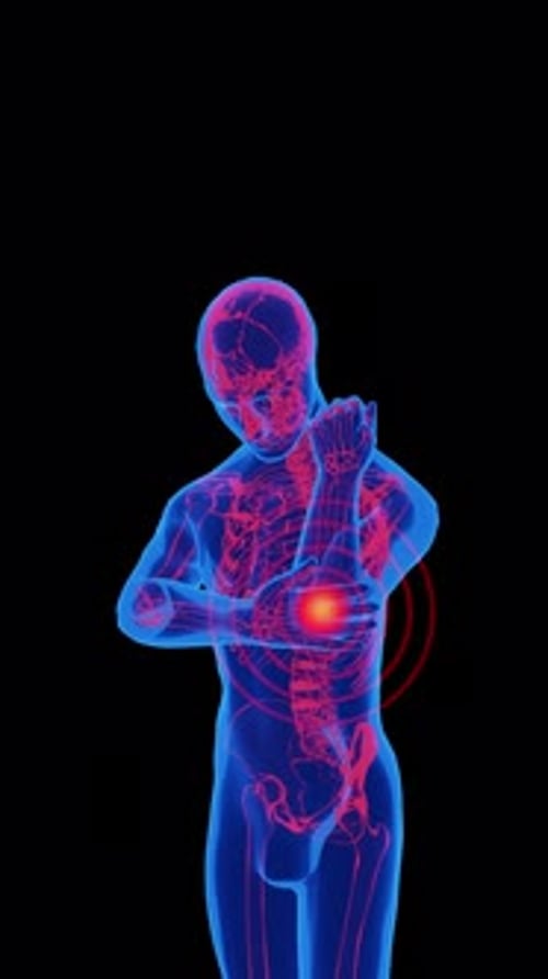 Illustration of elbow pain in human anatomy portrait