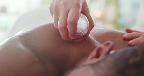 Closeup of a massage vacuum cup used at a clinic