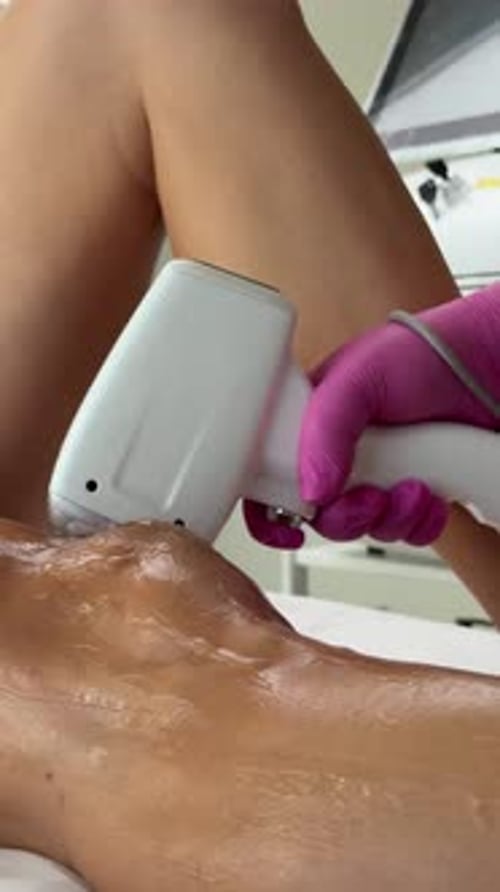 Woman Leg Receiving Laser Hair Removal Treatment