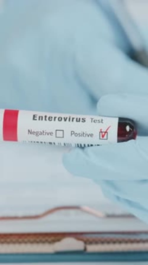 Enterovirus Test Vial Shows Positive Result