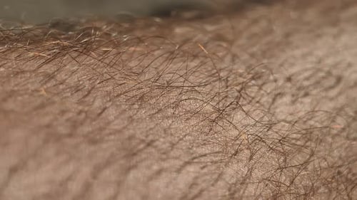 Extreme CloseUp View Of Hair Follicles On Human Skin