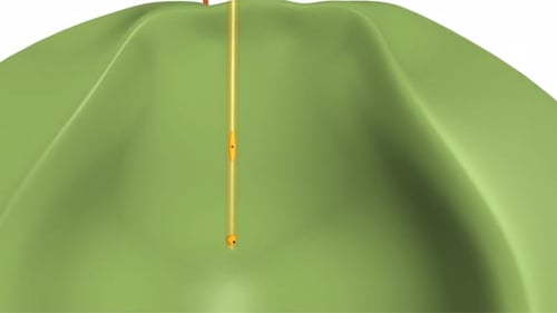 Catéter médico que realiza una simulación precisa de cirugía mínimamente invasiva