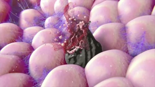 Microscopic Cell Damage Animation