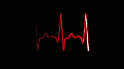 Heartbeat Rhythm Displayed on an EKG Monitor in Dynamic Motion