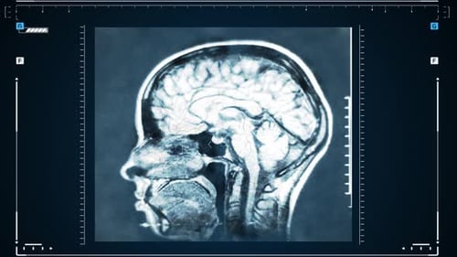 Animated Futuristic Medical Brain Scan Interface Display