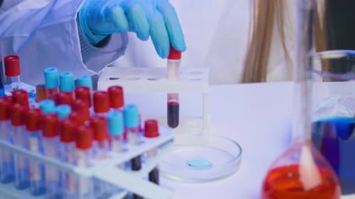 Lab Assistant in Gloves Putting Blood Test Tubes in Rack or Holder Close Up