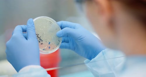Scientist Holds Petri Dish in Medical Lab
