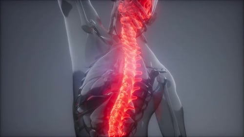 Backache in Back Bones
