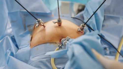 Laparoscopic Surgery in Brightly Lit Operating Room