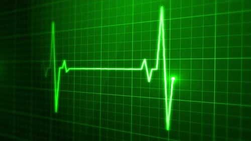 Digitale EKG-Impuls-Bildschirmschleife