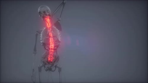 Backache in Back Bones