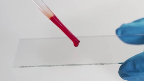 Eine Nahaufnahme eines Wissenschaftlers im Labor untersucht Blutkrankheiten