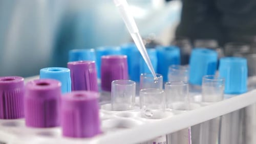 Researcher Works with Pipette in Medical Laboratory